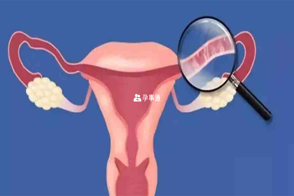 输卵管上举的女性受孕困难