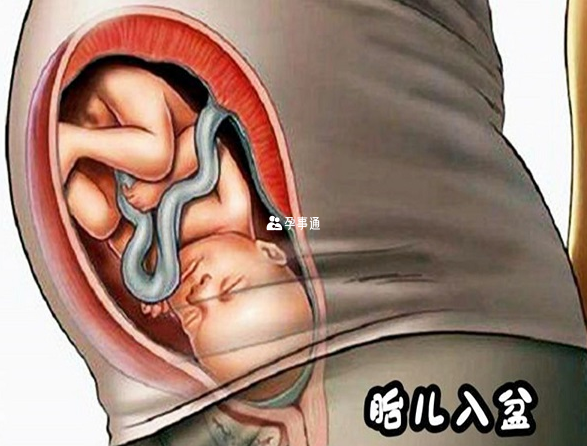 不同孕妇身体情况不同胎儿入盆的时间也有差异