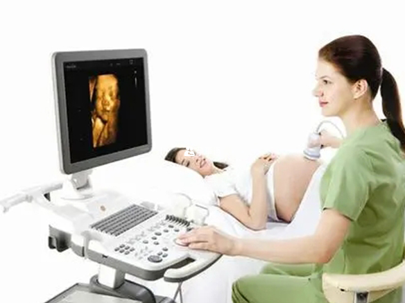 三维彩超孕囊大小可以看胎儿性别