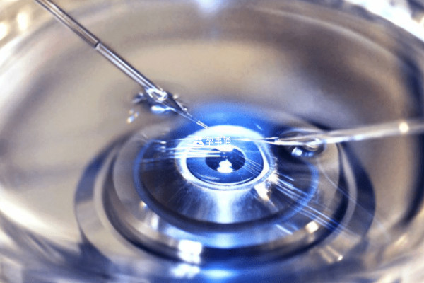 宝岛医院的单精子显微注射仪