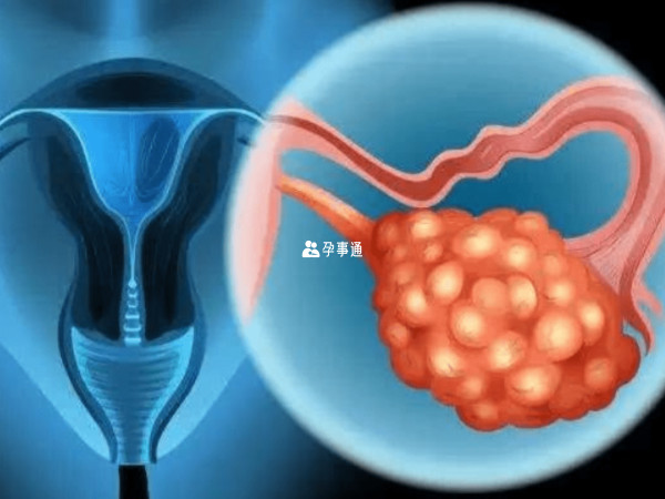 amh0.29已代表卵巢严重衰竭