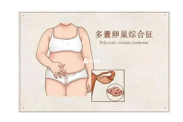 多囊女性怀孕方法介绍