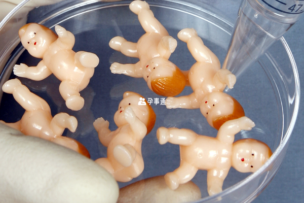 宁波妇儿医院胚胎移植成功率一览
