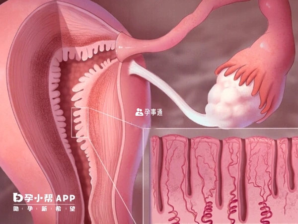 子宫内膜厚度会随着月经周期便