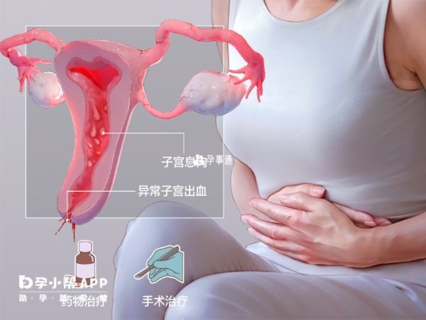 子宫息肉可以做试管助孕