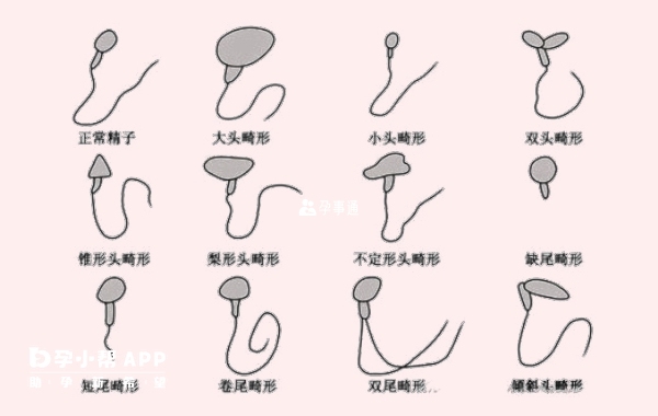 精子畸形是不利于怀孕的