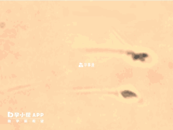 圆头精子也就是精子畸形