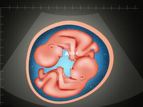 鲜胚移植两个可能双胎
