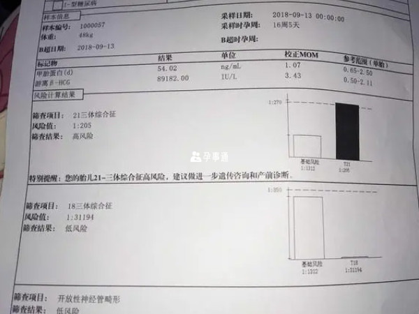 唐氏筛查单看男女的方式都是没有依据的