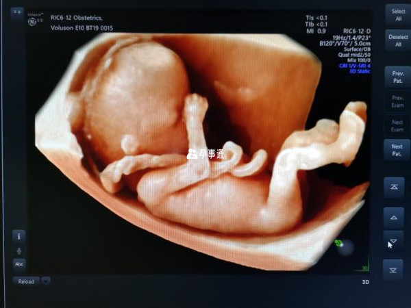 膀胱可见只能说明宝宝的泌尿器官是正常的
