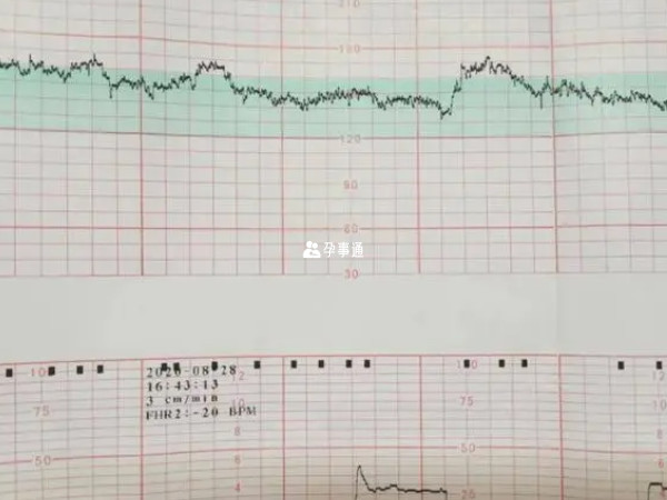 胎心率是监测胎儿是否正常的一个指标