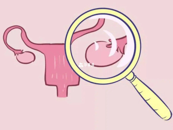 卵巢囊肿可以做有氧运动