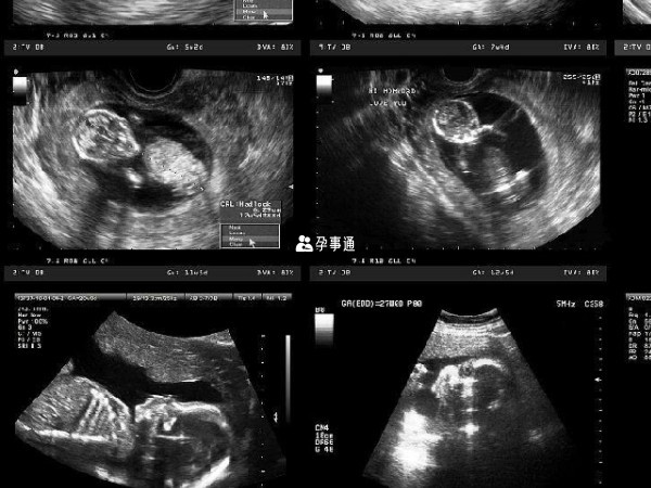 胎儿的不同生长发育阶段