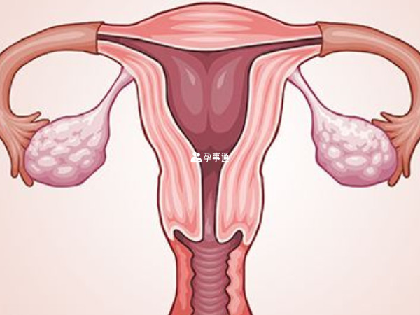 子宫内膜癌阴道细胞学检查诊断率低于子宫颈癌