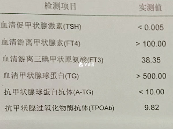 游离甲状腺素过高过低都不正常