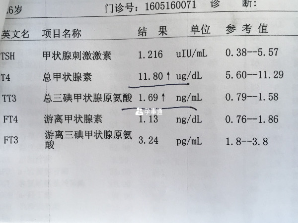 甲狀腺功能判斷指標及結果