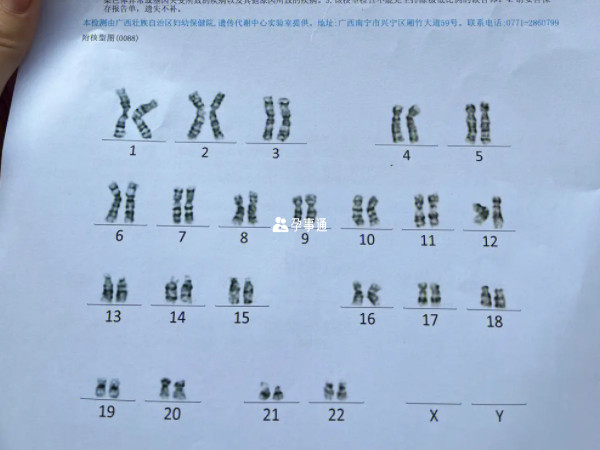 正常情况下一个人有22对常染色体和1对性染色体