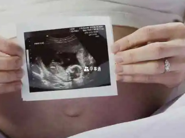 胎儿性别只能通过专业医学仪器检测