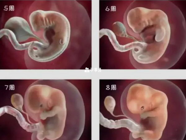 怀孕2个月胎儿真实图