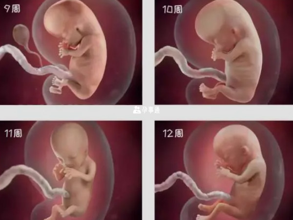 怀孕3个月胎儿真实图