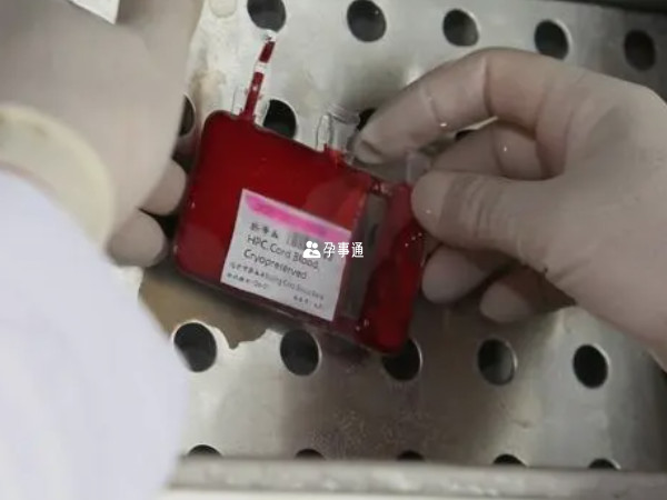 北京脐带血穿刺医院