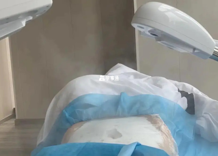 南京妊娠纹修复医院