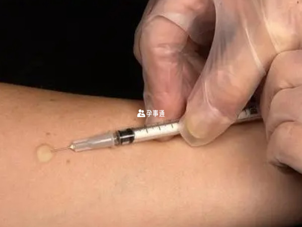 郑州可以接种脊灰疫苗