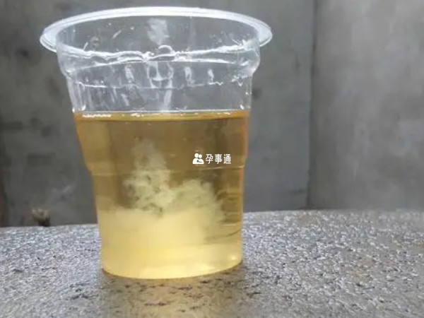 酒精加尿有絲狀物就是男孩