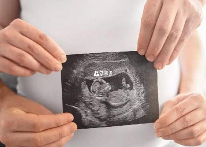 怀孕18周检查是男孩可能生女孩