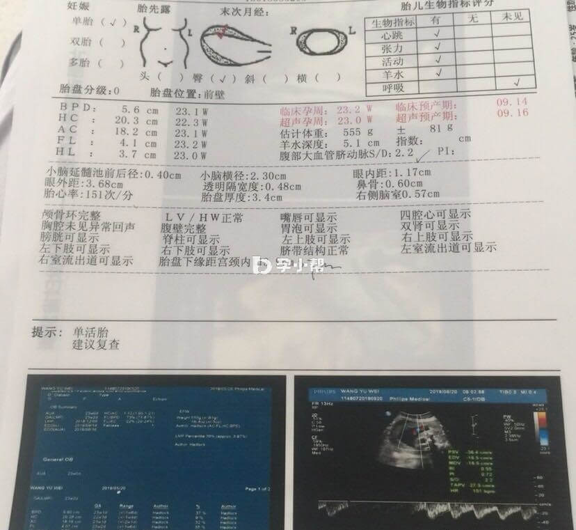 湖北省妇幼大排畸预约电话