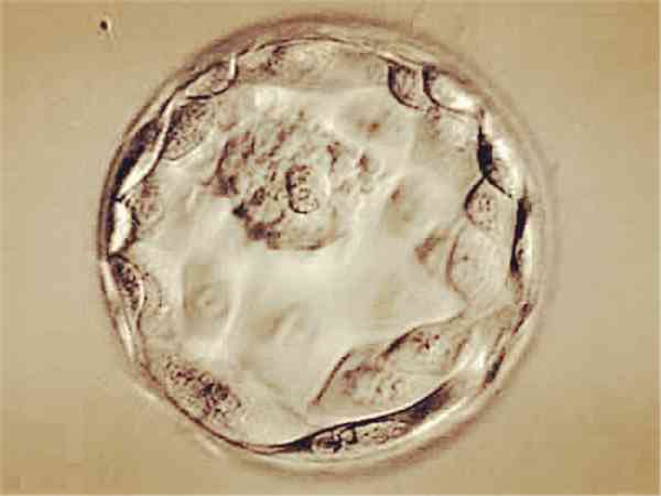 厦门第一医院试管婴儿放的是囊胚还是鲜胚