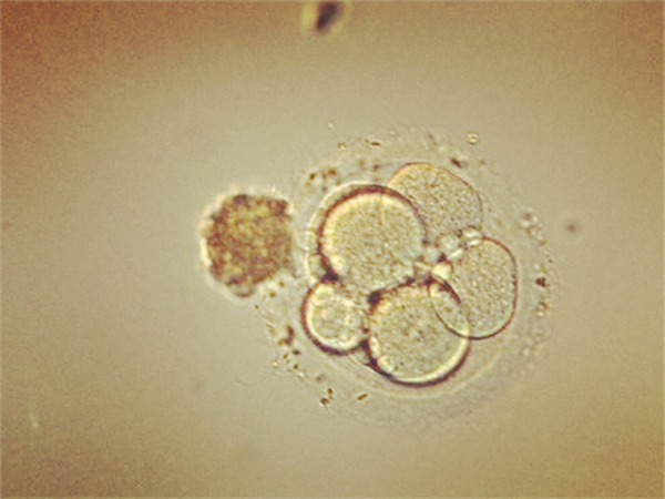 試管嬰兒放囊胚著床成功率高