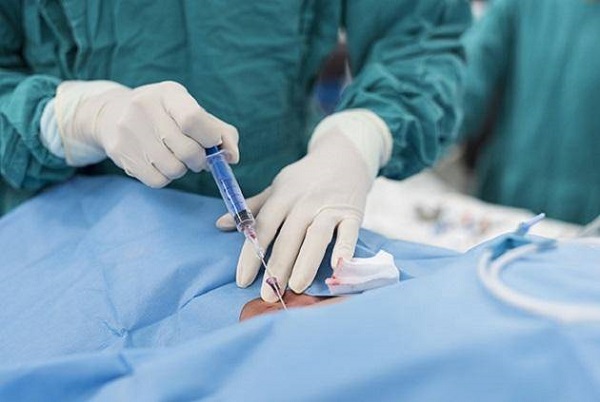 局部麻醉是取卵手术常用麻醉方式