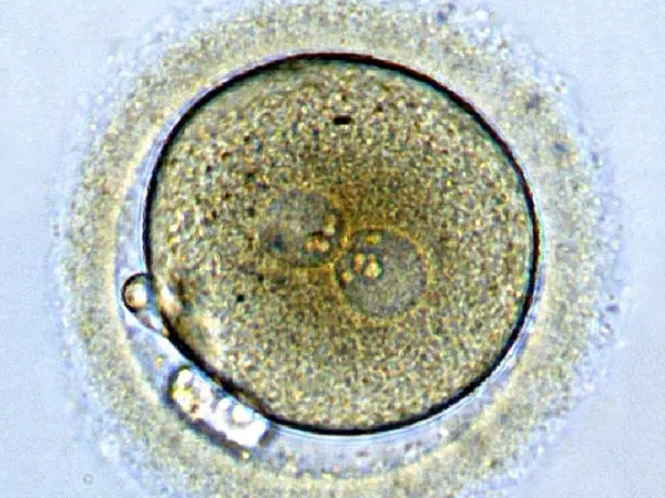 2pn胚胎
