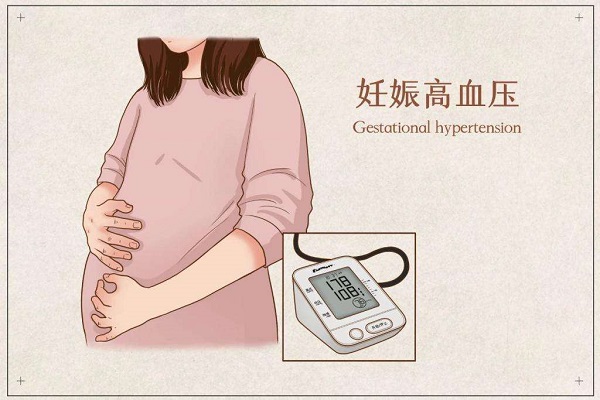 孕期服用润康可避免妊娠高血压